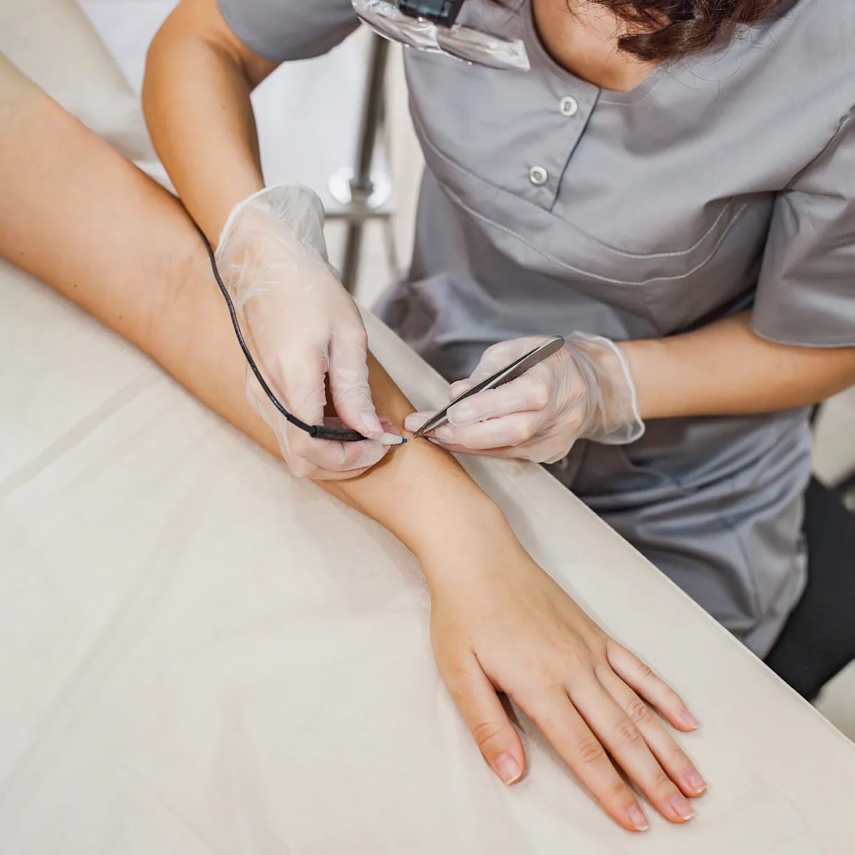 Radiant Skin Electrolysis
