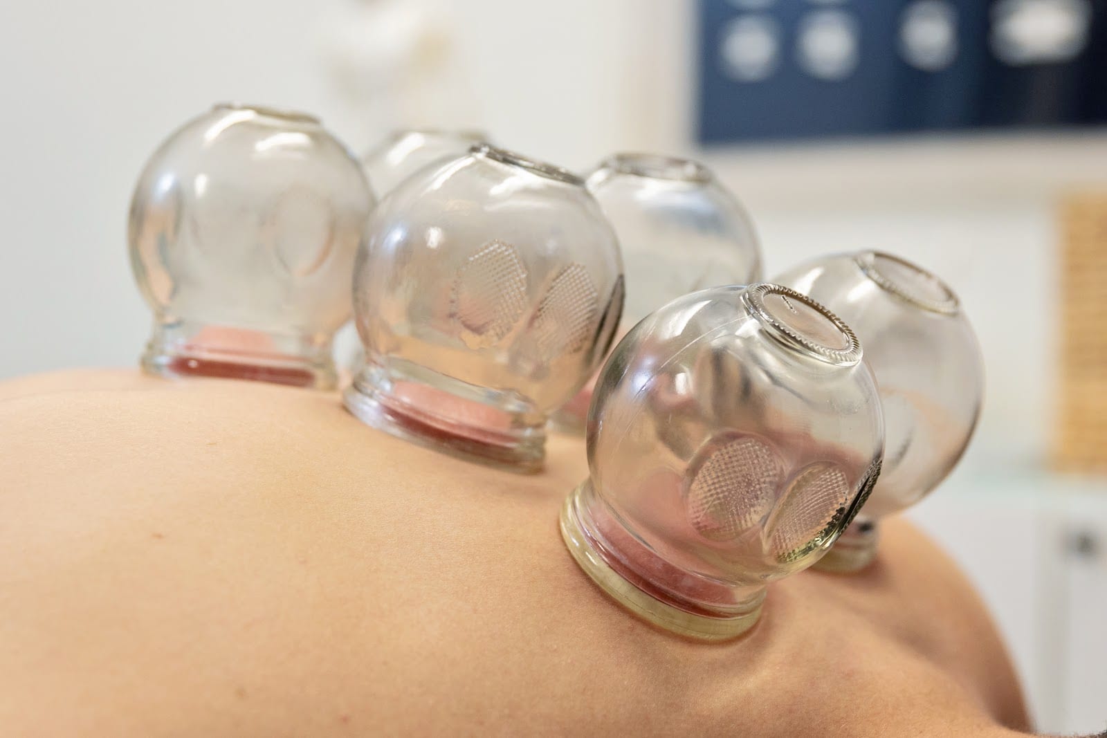 Alivia Acupuncture Clinic LLC, photo 4
