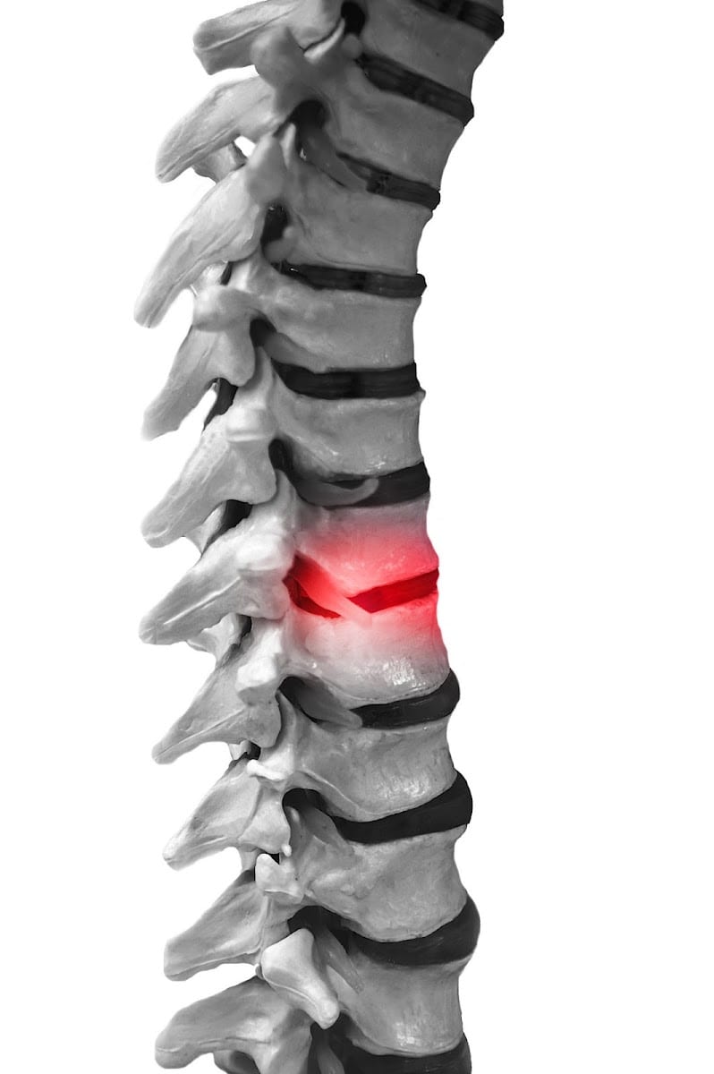 The Joint Chiropractic