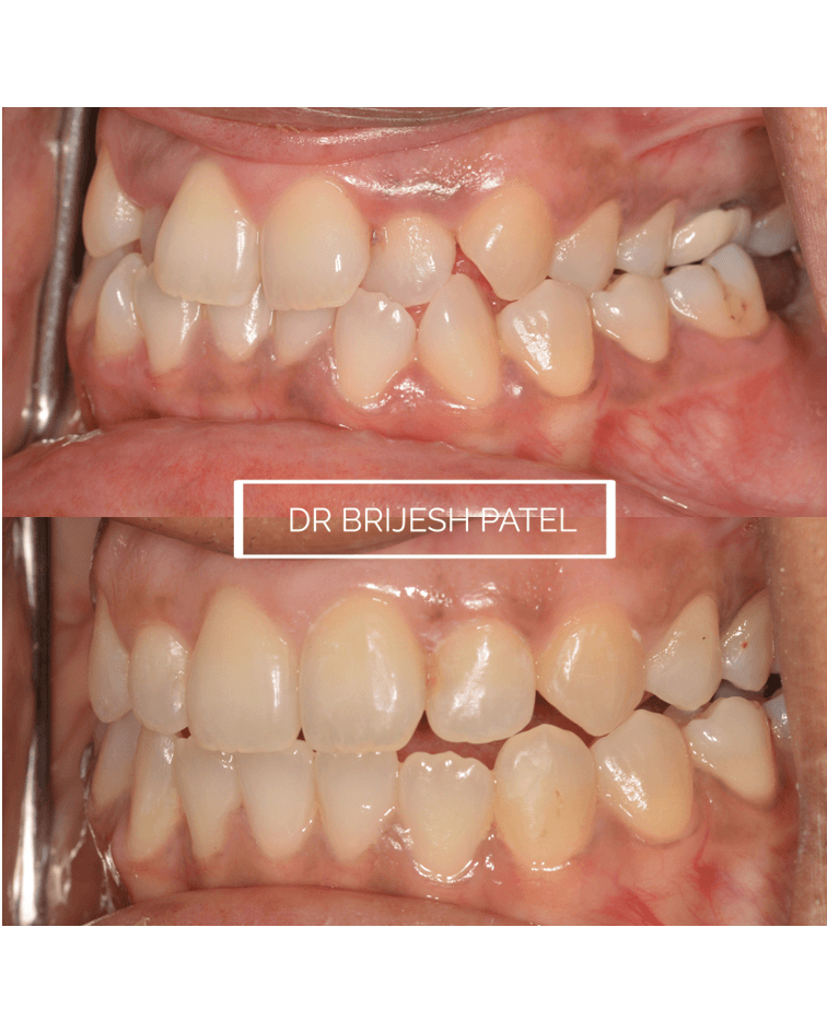 Dr Brijesh Patel Dentistry