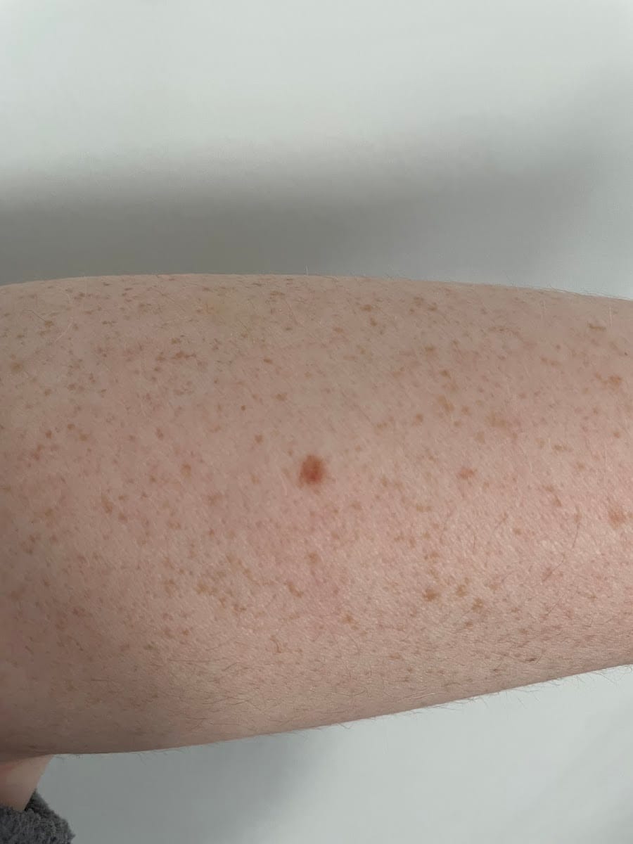 Piction Health Dermatology - San Francisco, photo 2