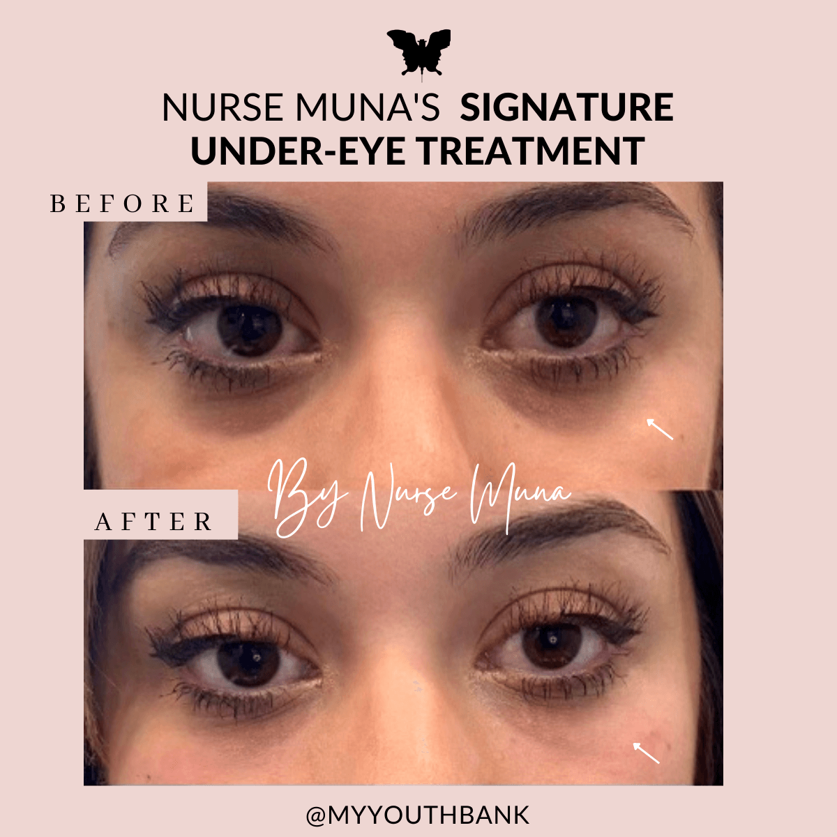 My Youth Bank Med Spa Orange County