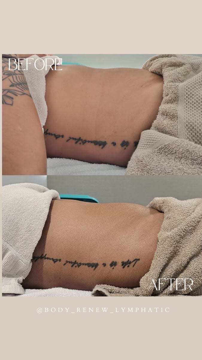 Body Renew Mackay, photo 4
