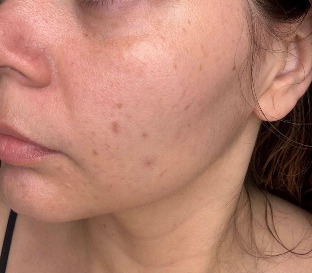 Rutina Skincare, photo 4