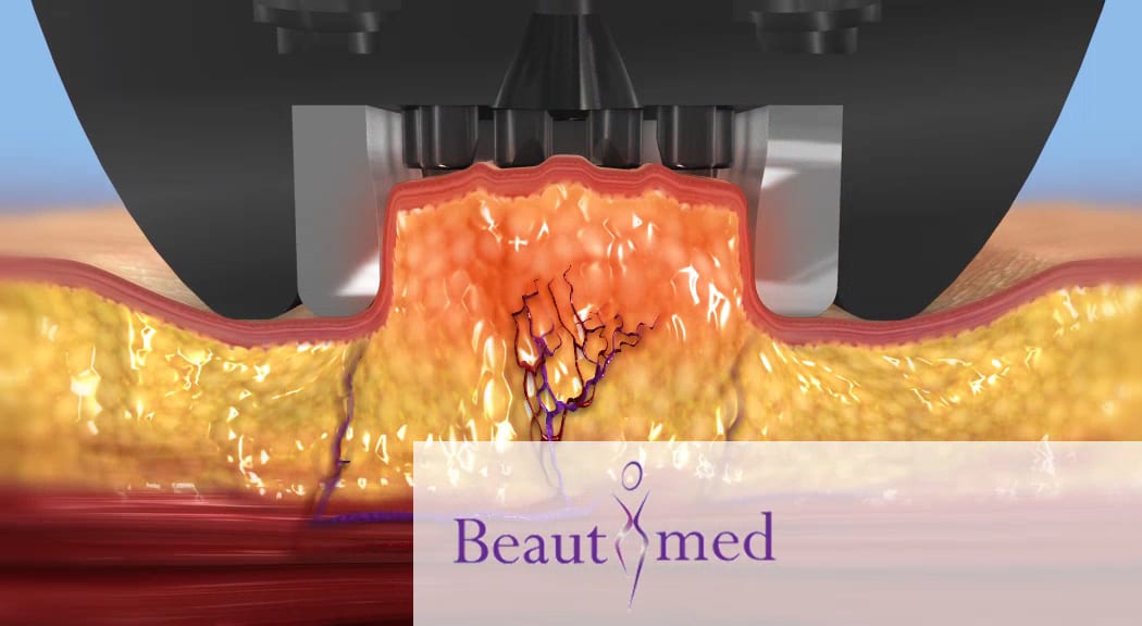 Beauty Med Cosmetic Clinic, photo 3