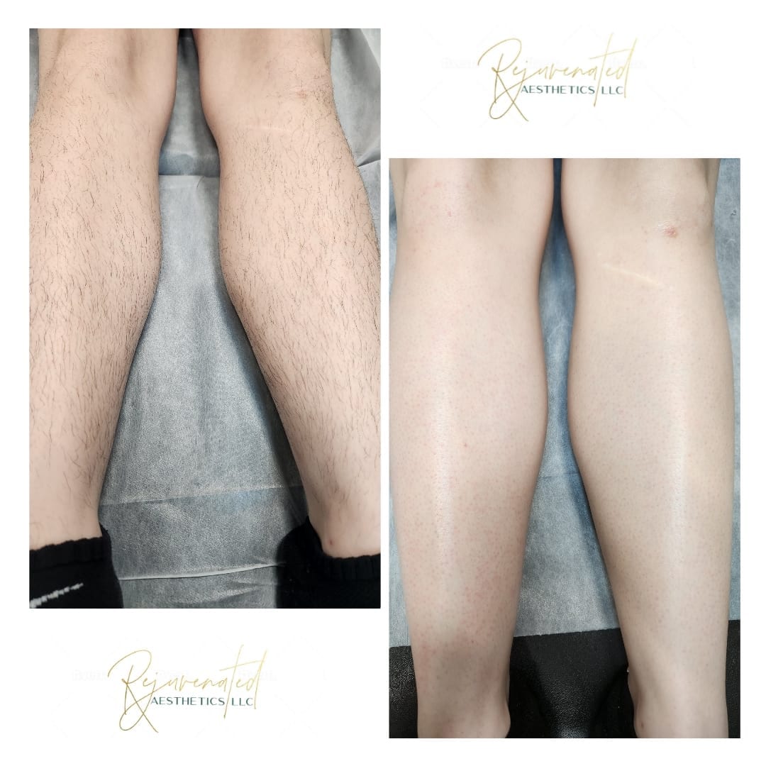 Rejuvenated Aesthetics LLC, photo 2