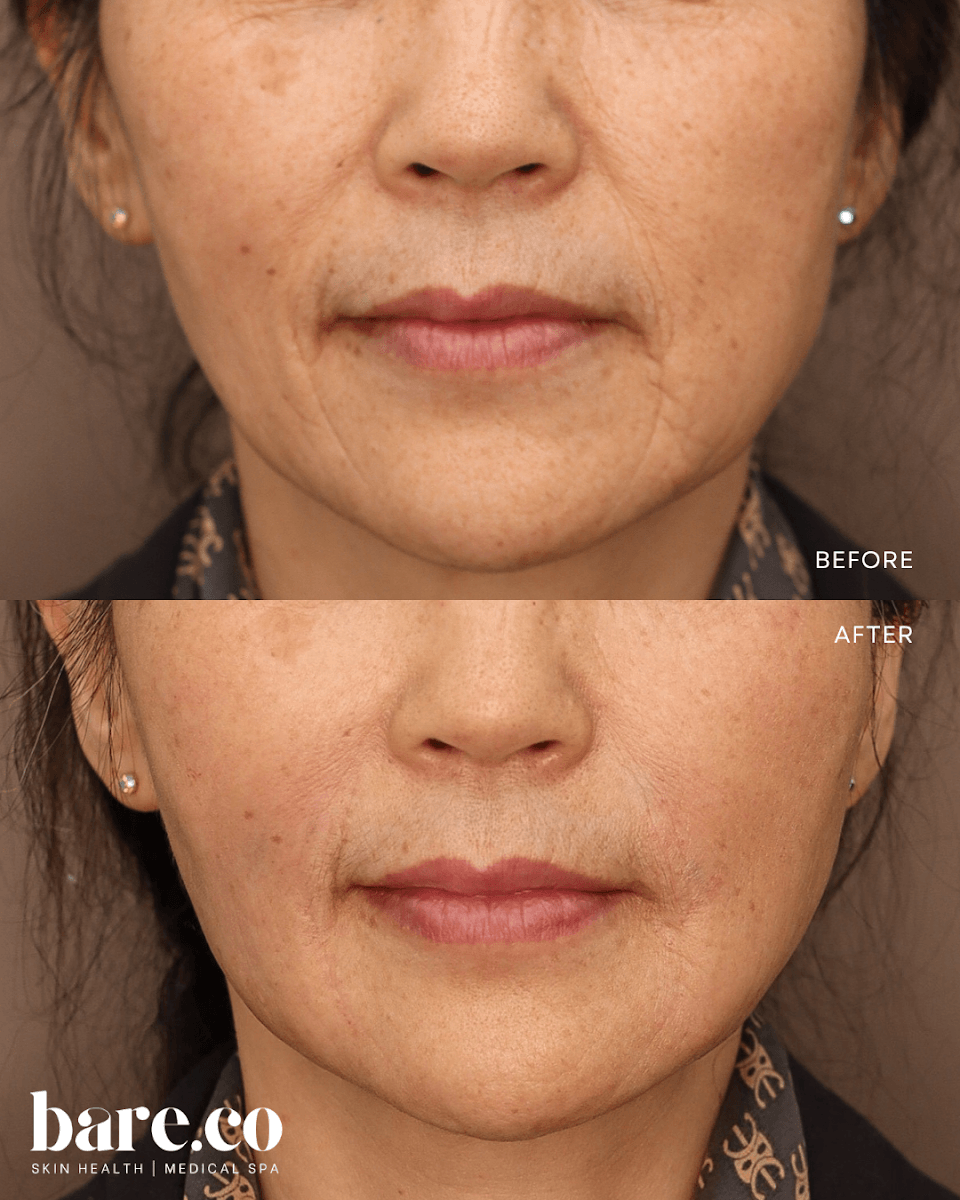 Bare.co Skin Health and Medical Spa, photo 3