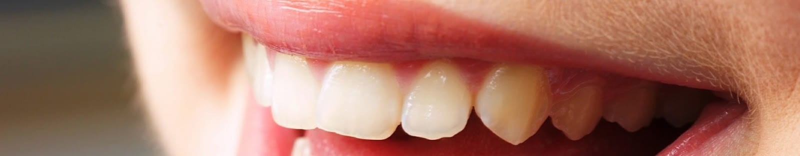 Anderson General Dentistry