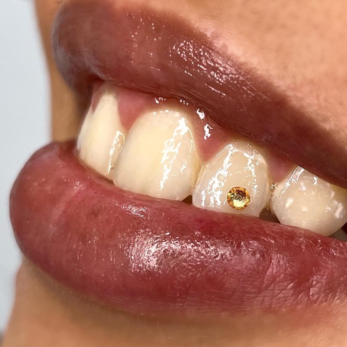 Bright Smile Studio