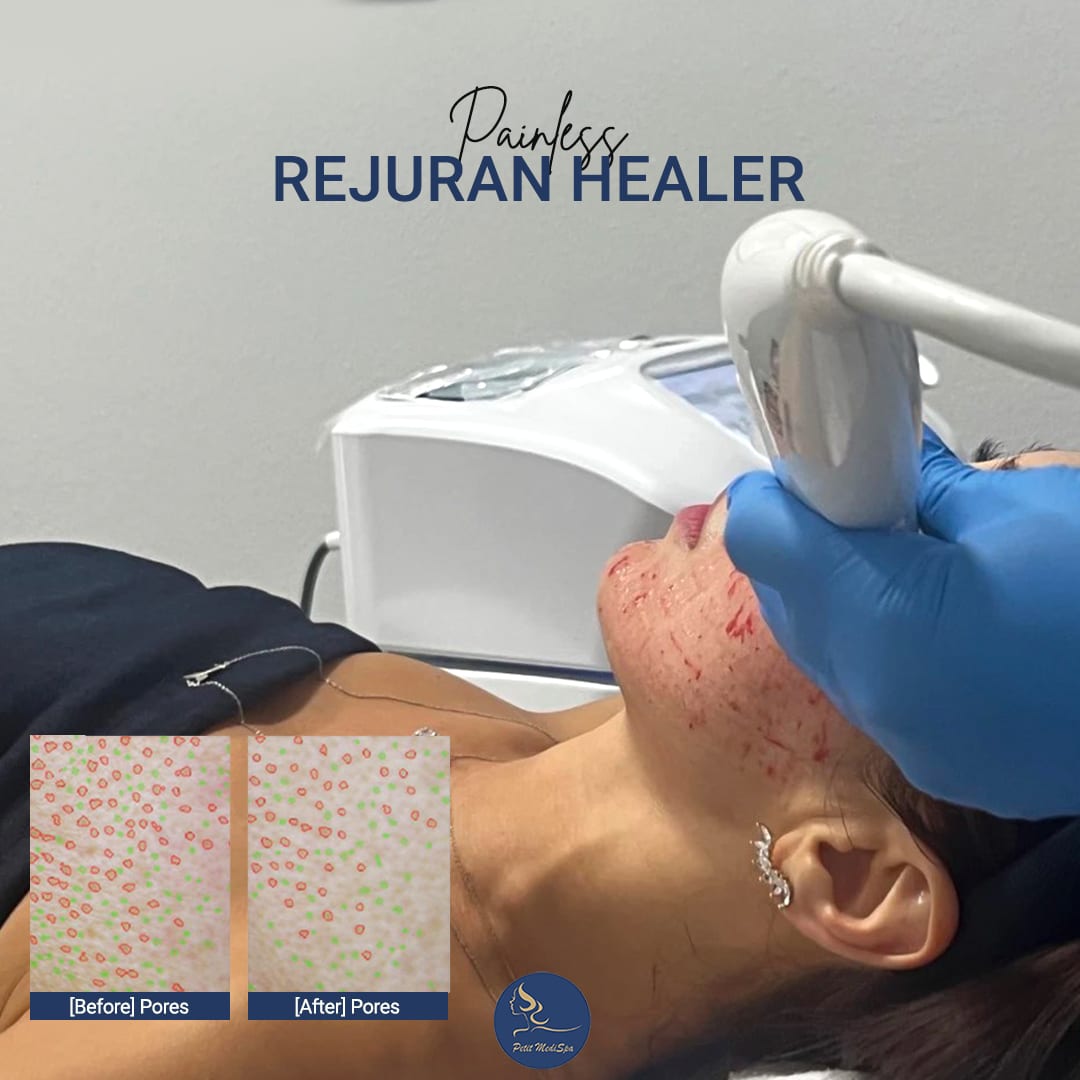 Petit Medispa