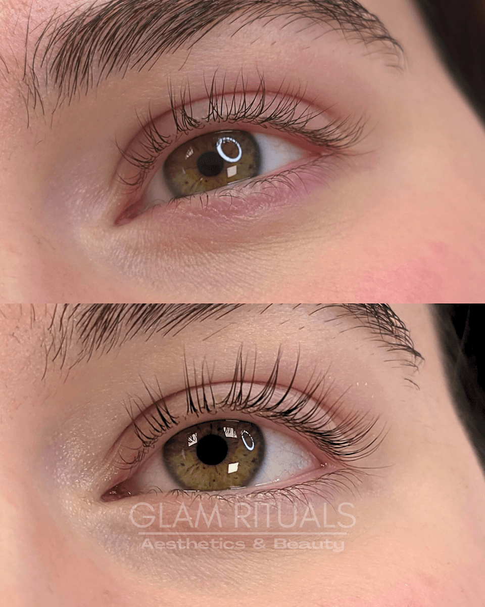 Glam Rituals Aesthetics & Beauty