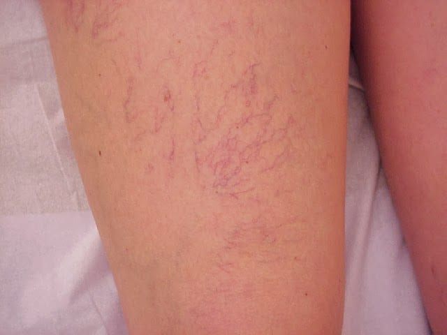 Vein Clinic SCOVAS, photo 2