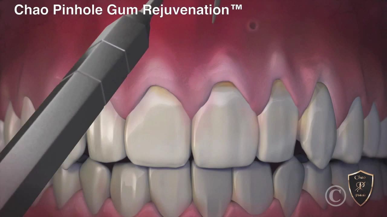 Young Family & Cosmetic Dentistry, photo 2