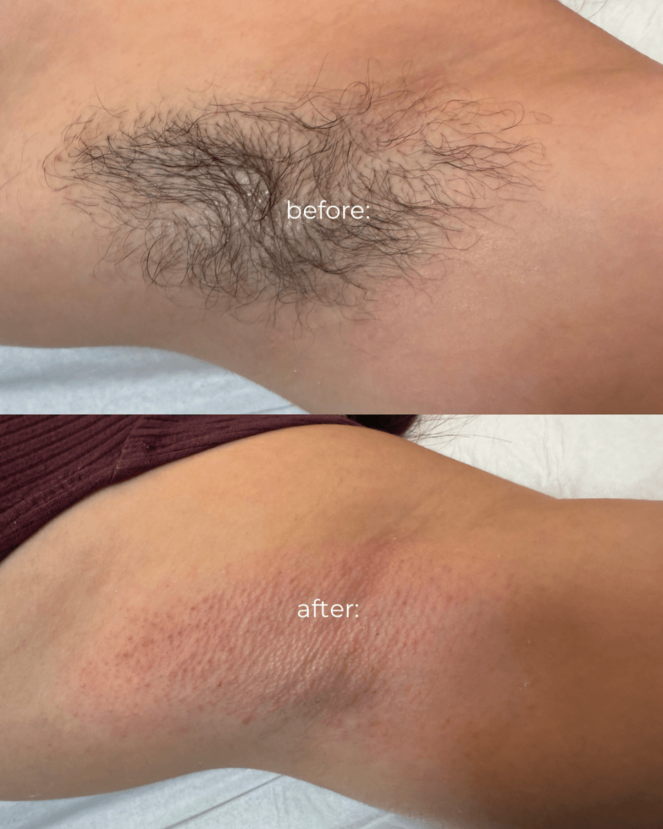 Uni K Wax | Scottsdale - All Natural Waxing Studio