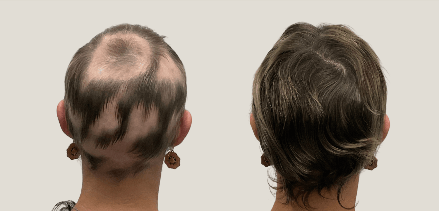 National Hair Loss Medical Aesthetics, photo 4