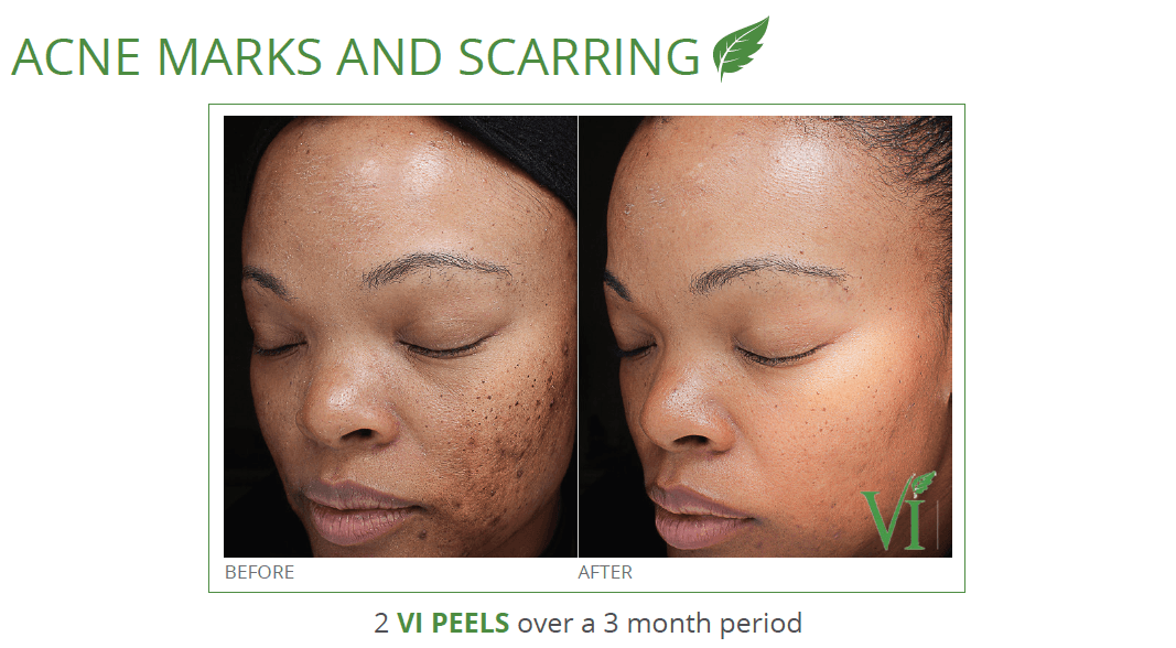 Pure Health Medical | Naturopathic Medicine & Med Spa, photo 4