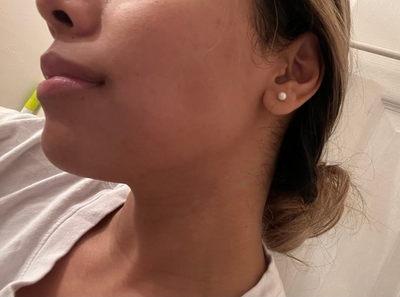 Soraya Laser Hair Removal and Skincare Services