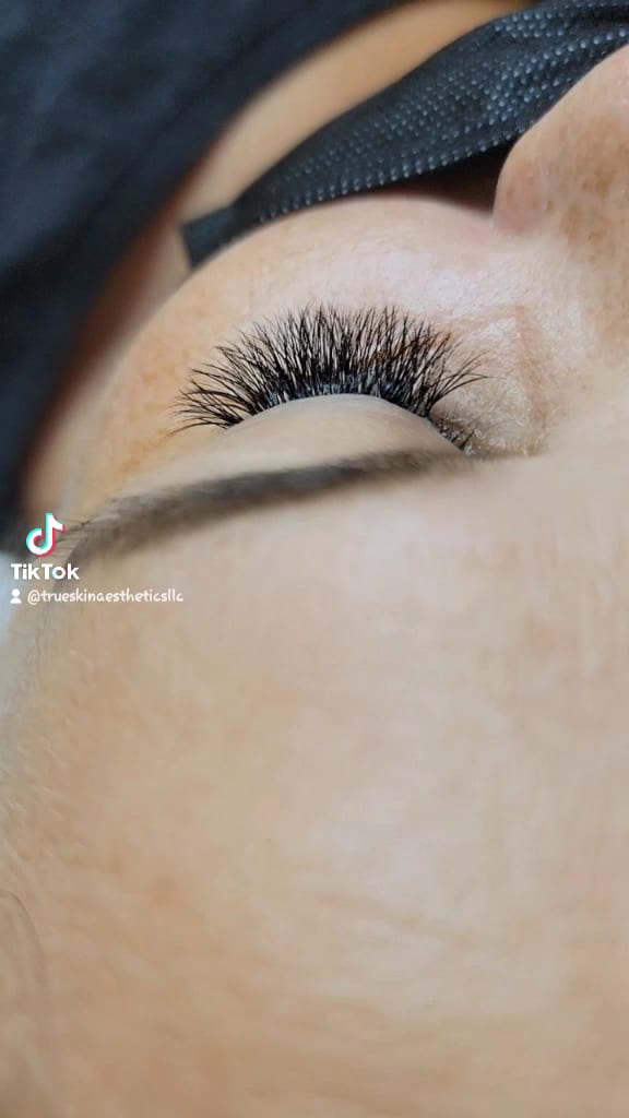 True Skin Aesthetics LLC, photo 4