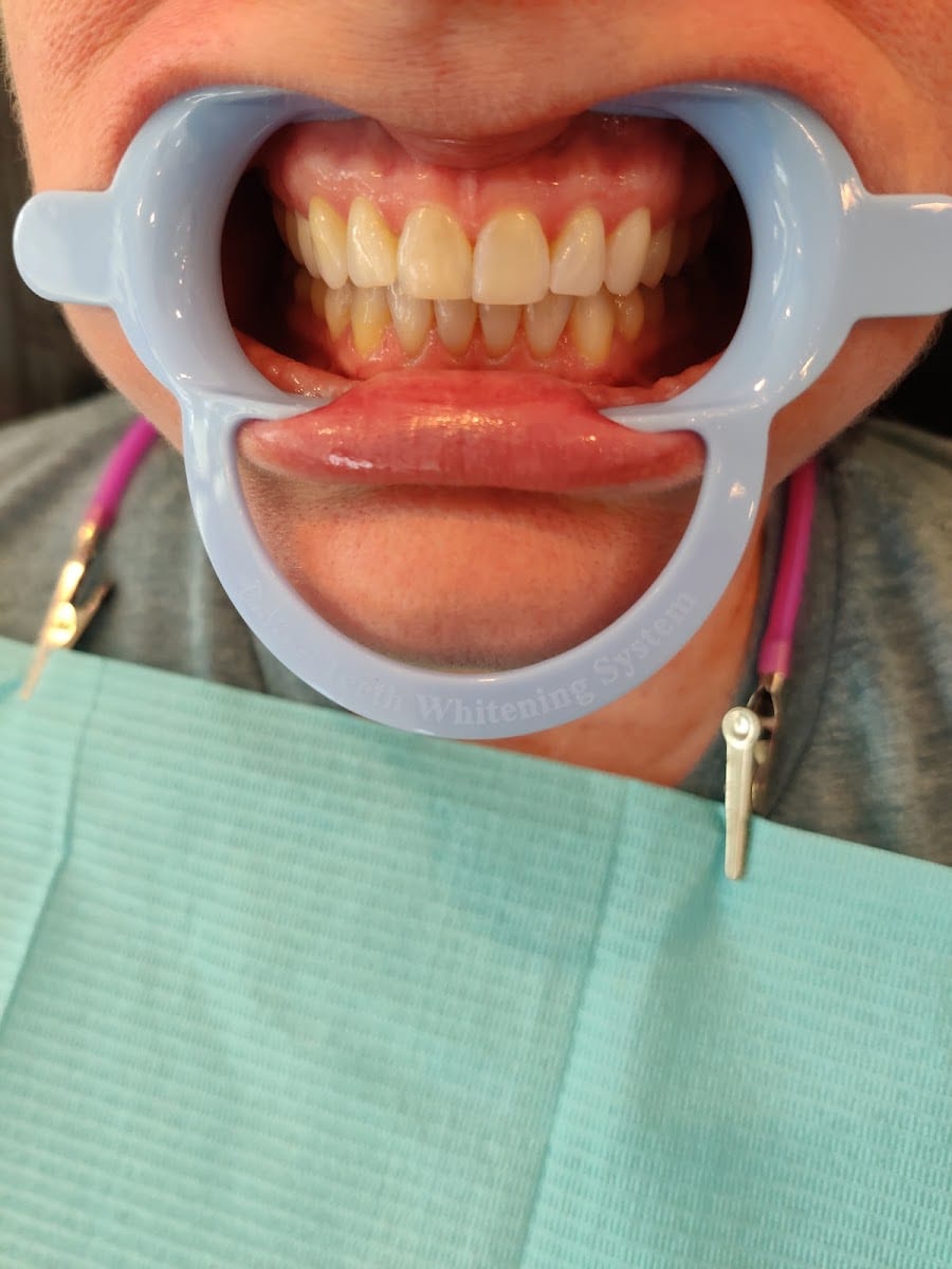 DaVinci Teeth Whitening of Venice, photo 2