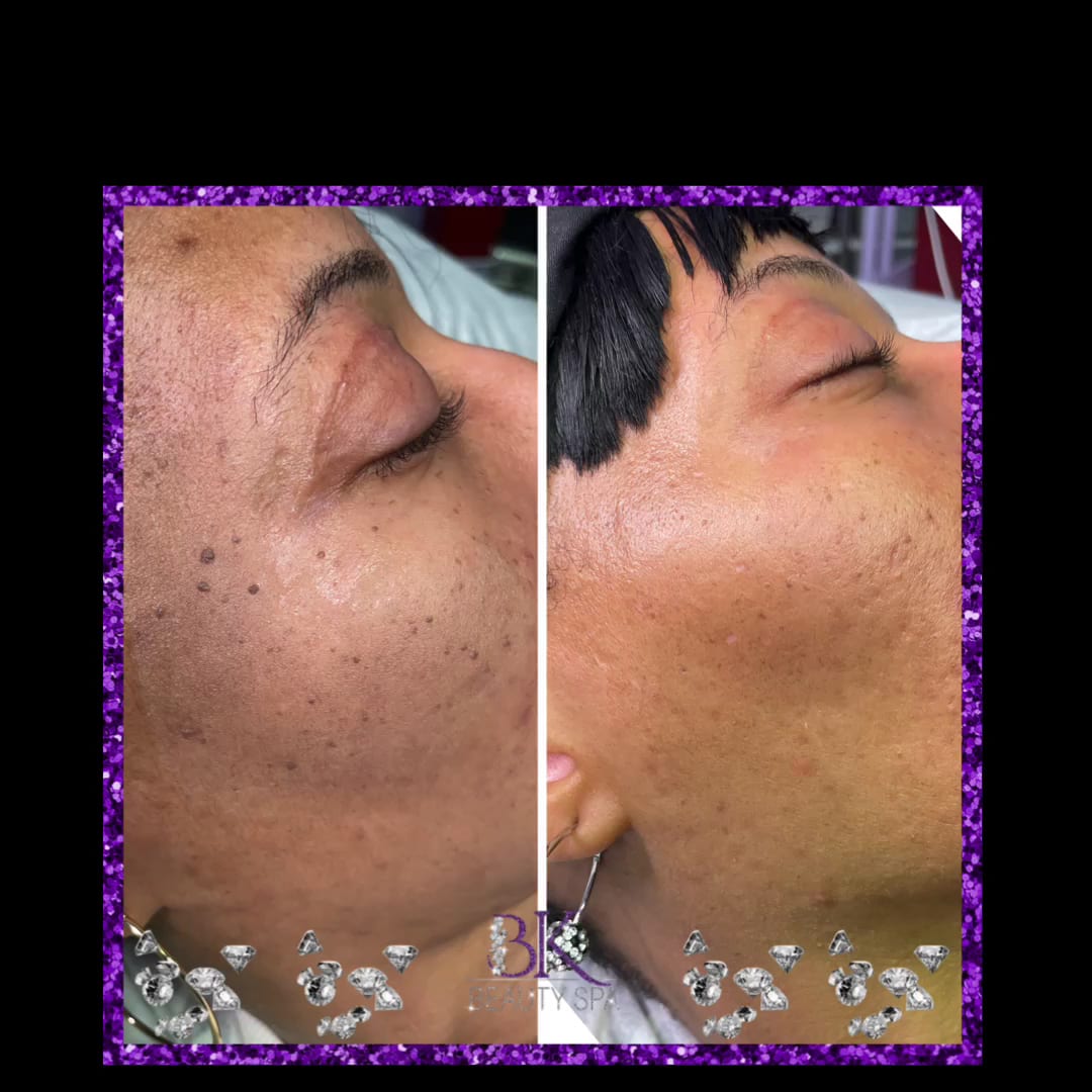 BodyKandie Beauty Spa, photo 3