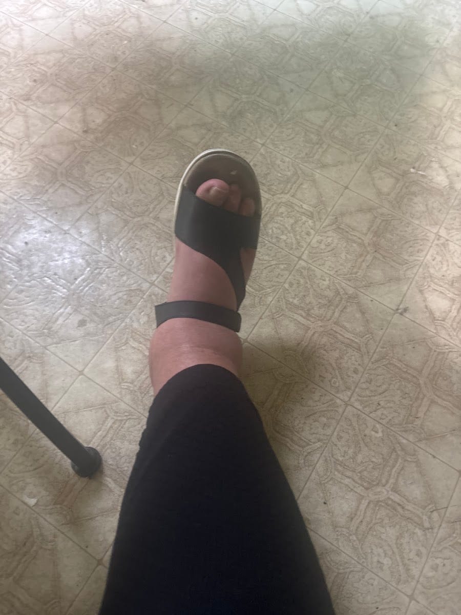 UCSF Foot & Ankle Service, photo 3