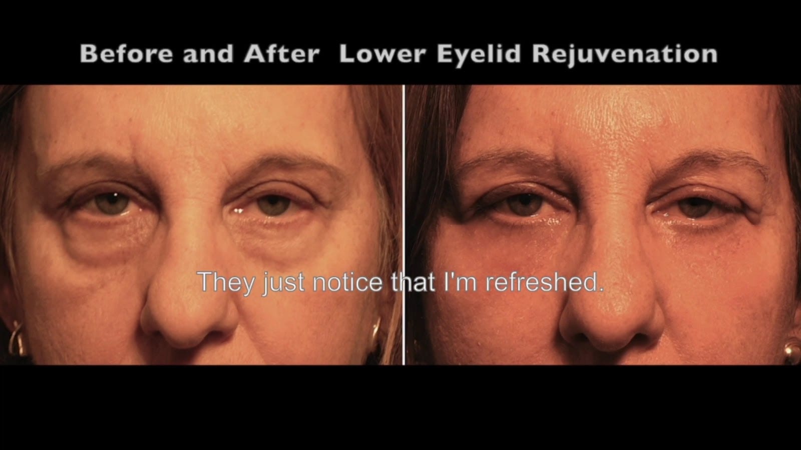 TAMPA EYE CLINIC AND ASSOCIATES, photo 2