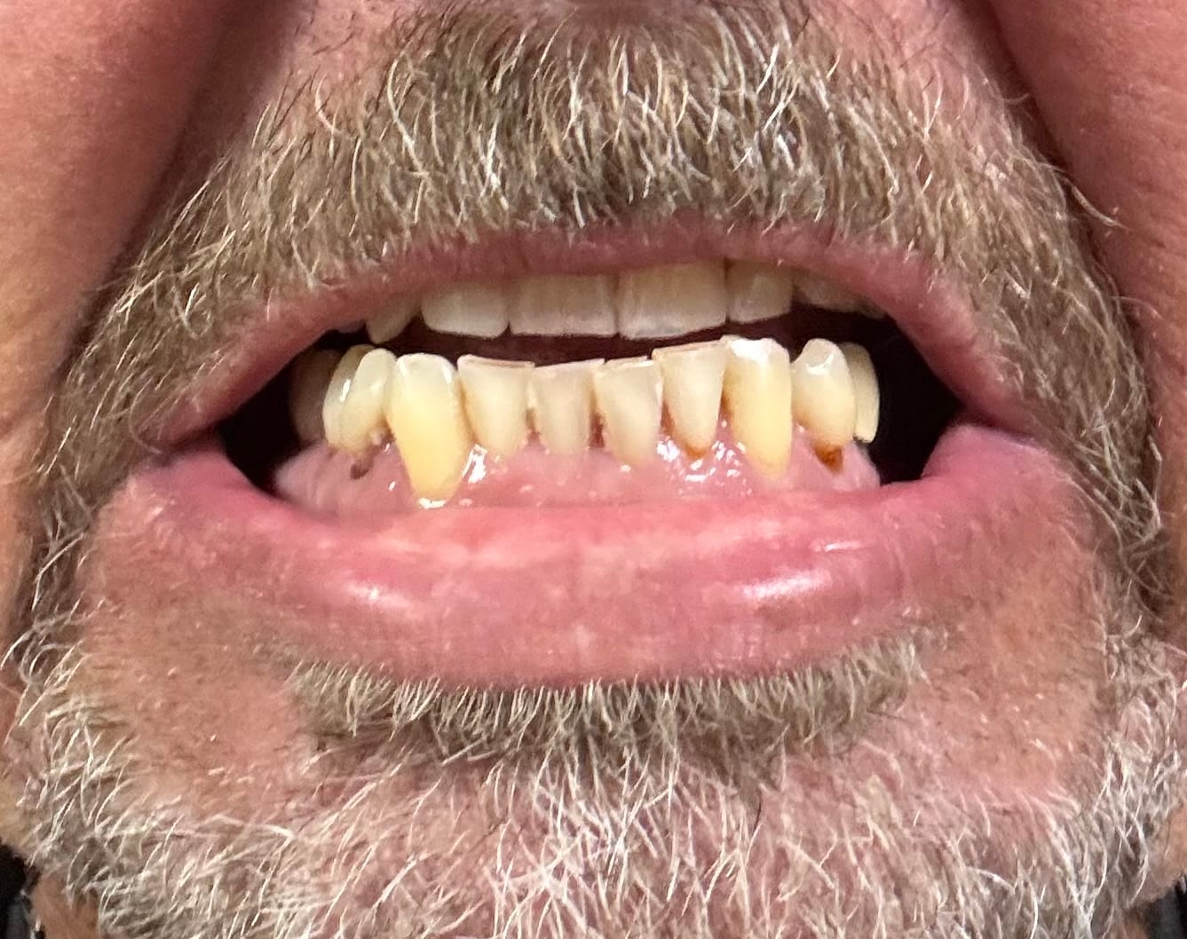 Comfort Dental of Anderson