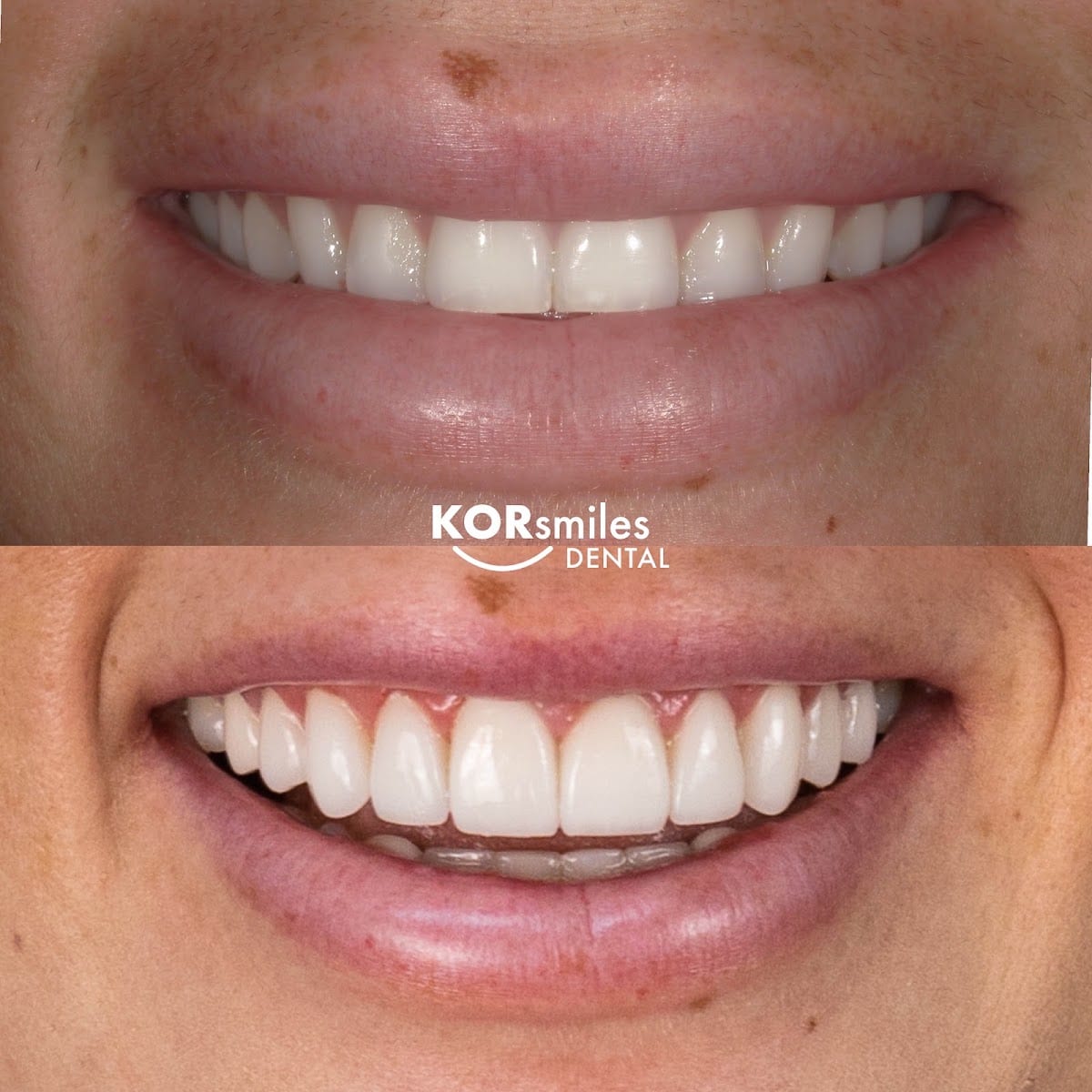 KORsmiles Dental