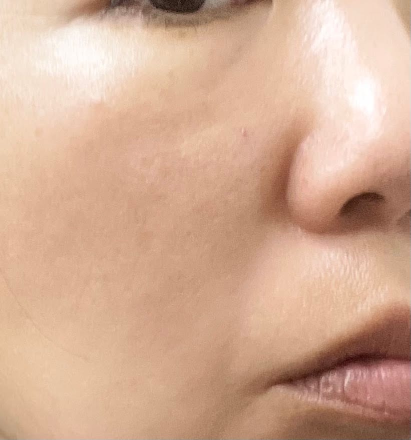 La Princesa Medispa, photo 4