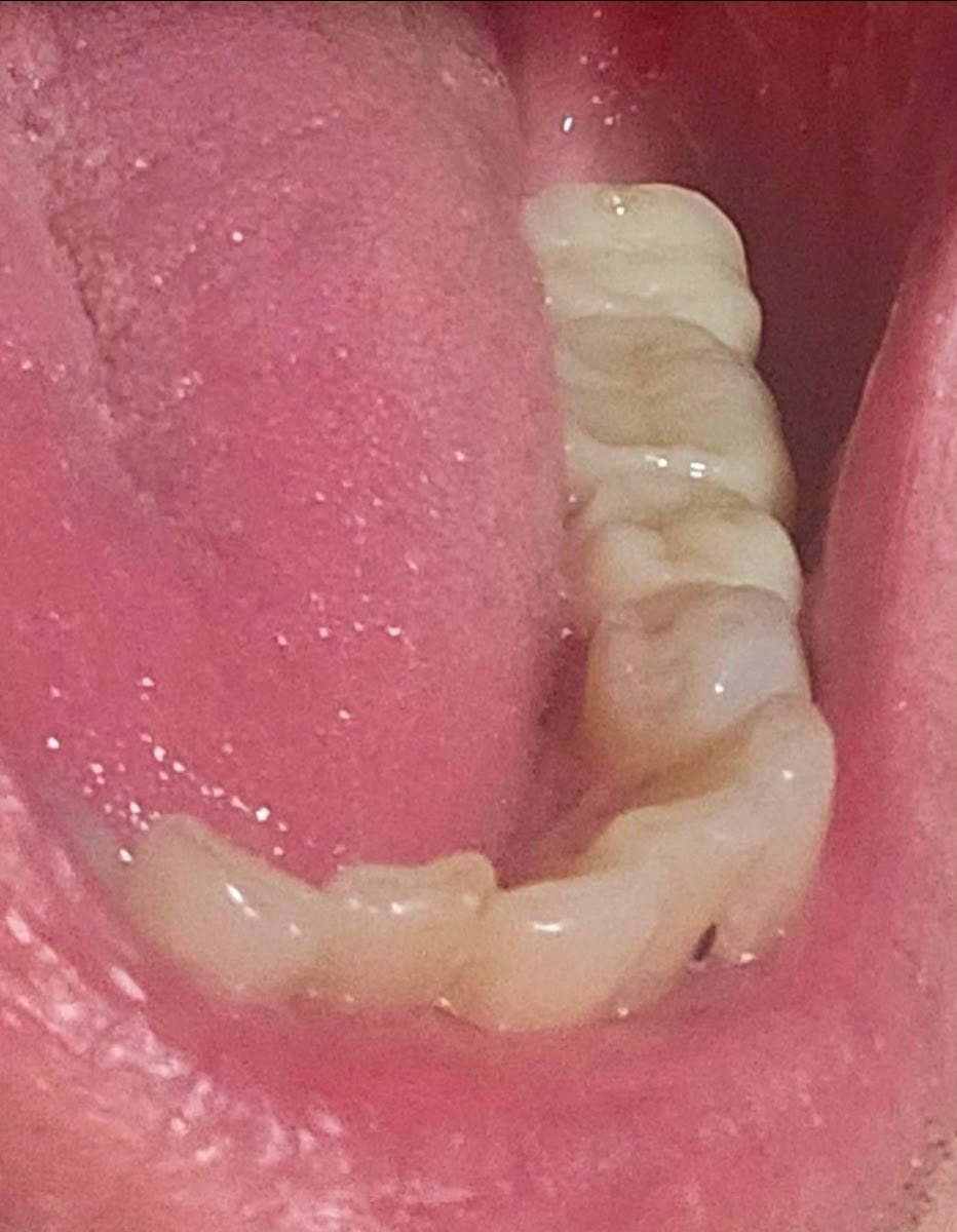 South County Dental - Englewood