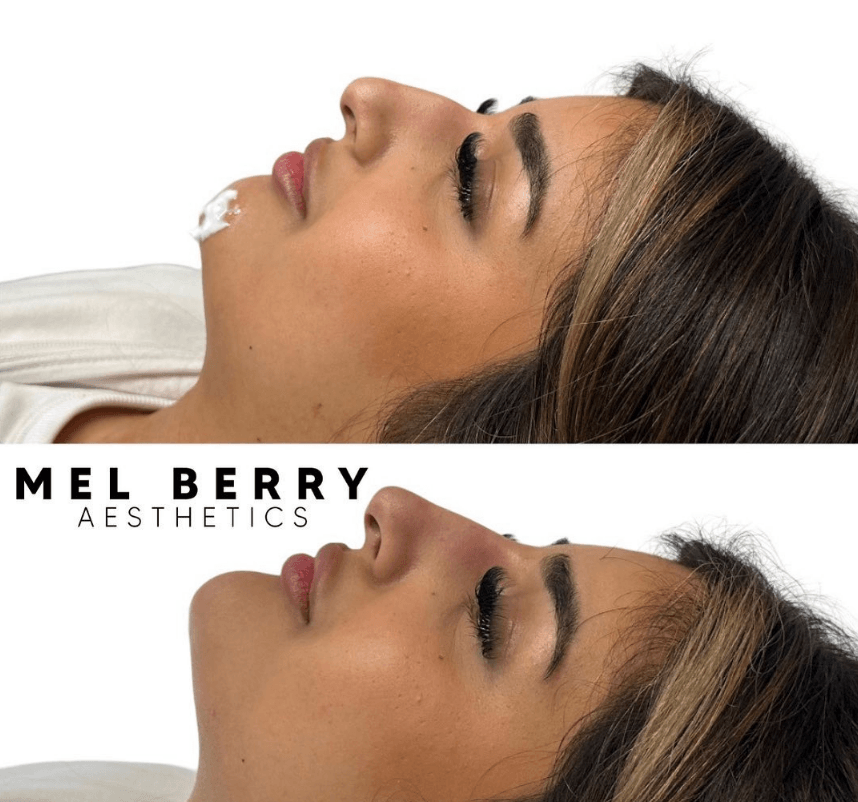 Mel Berry Aesthetics