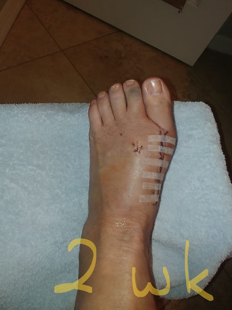 Foot and Ankle Centers of Charlotte County, photo 4
