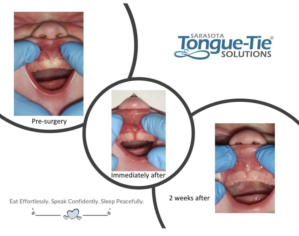 Sarasota Tongue-Tie Solutions, photo 4