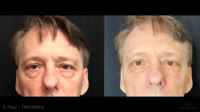 Fresh Start Aesthetics Med Spa, photo 3