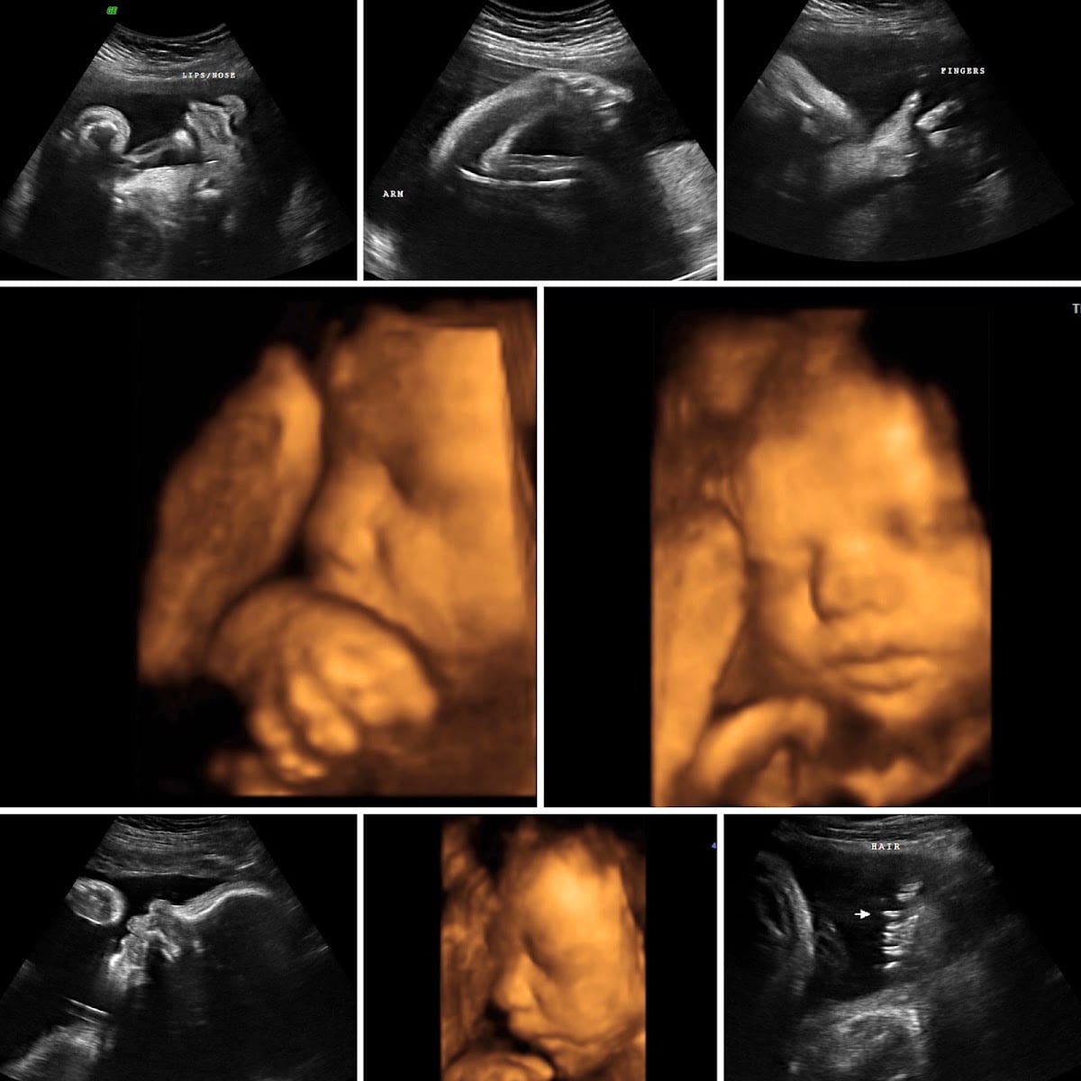 Bundle of Joy 3D/4D Studio of Beaumont, LLC, photo 4