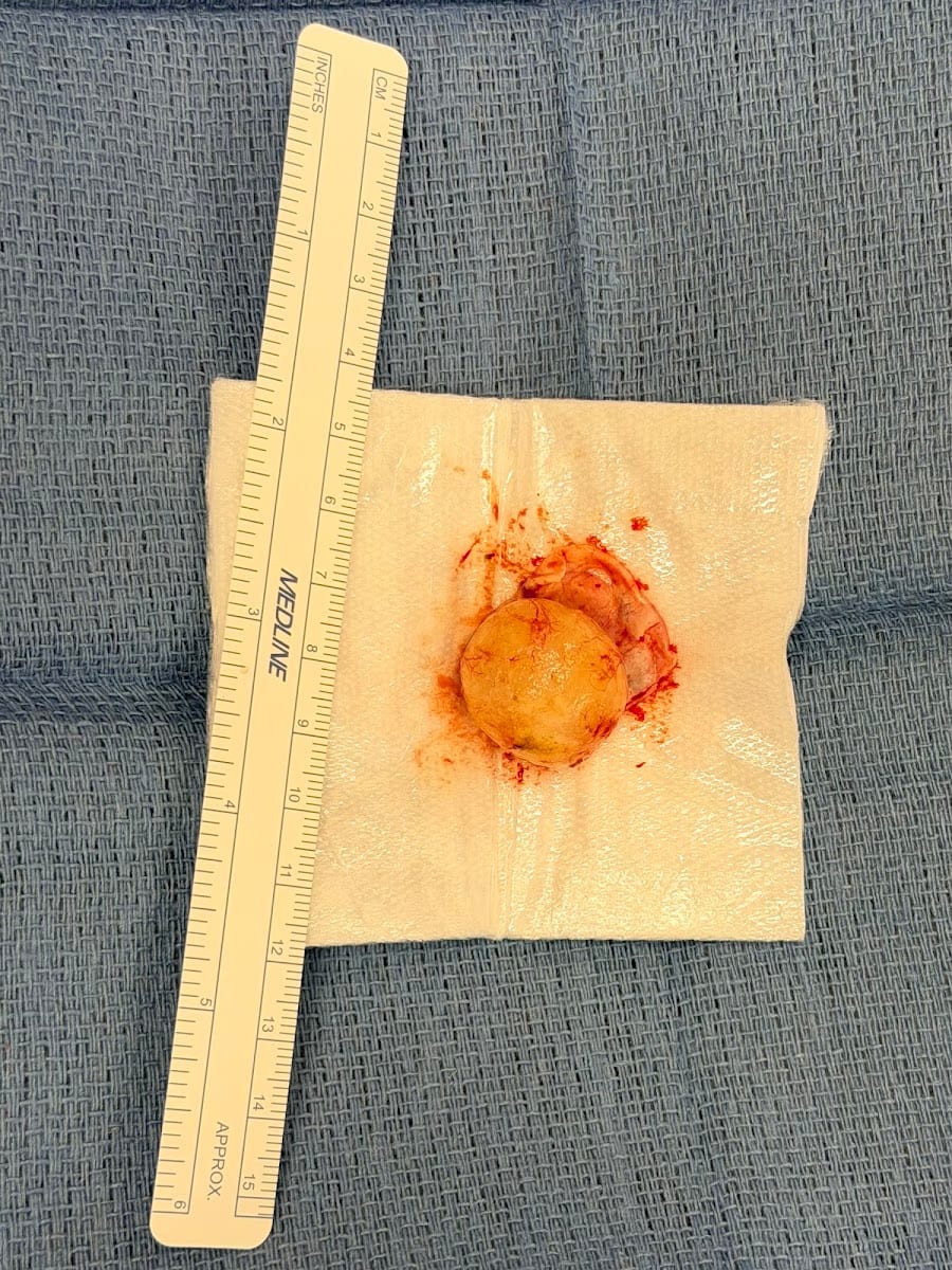 Michael T. Koltz, MD, photo 3