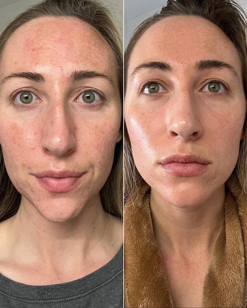 Skin Therapy Skincare and Wellness, photo 4