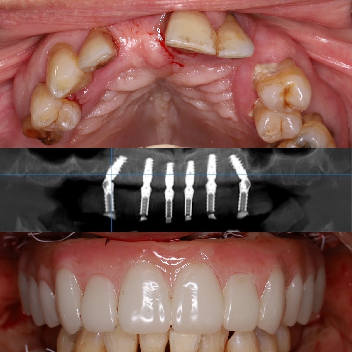 House Call Dental Sedation - Itani Dental, photo 4