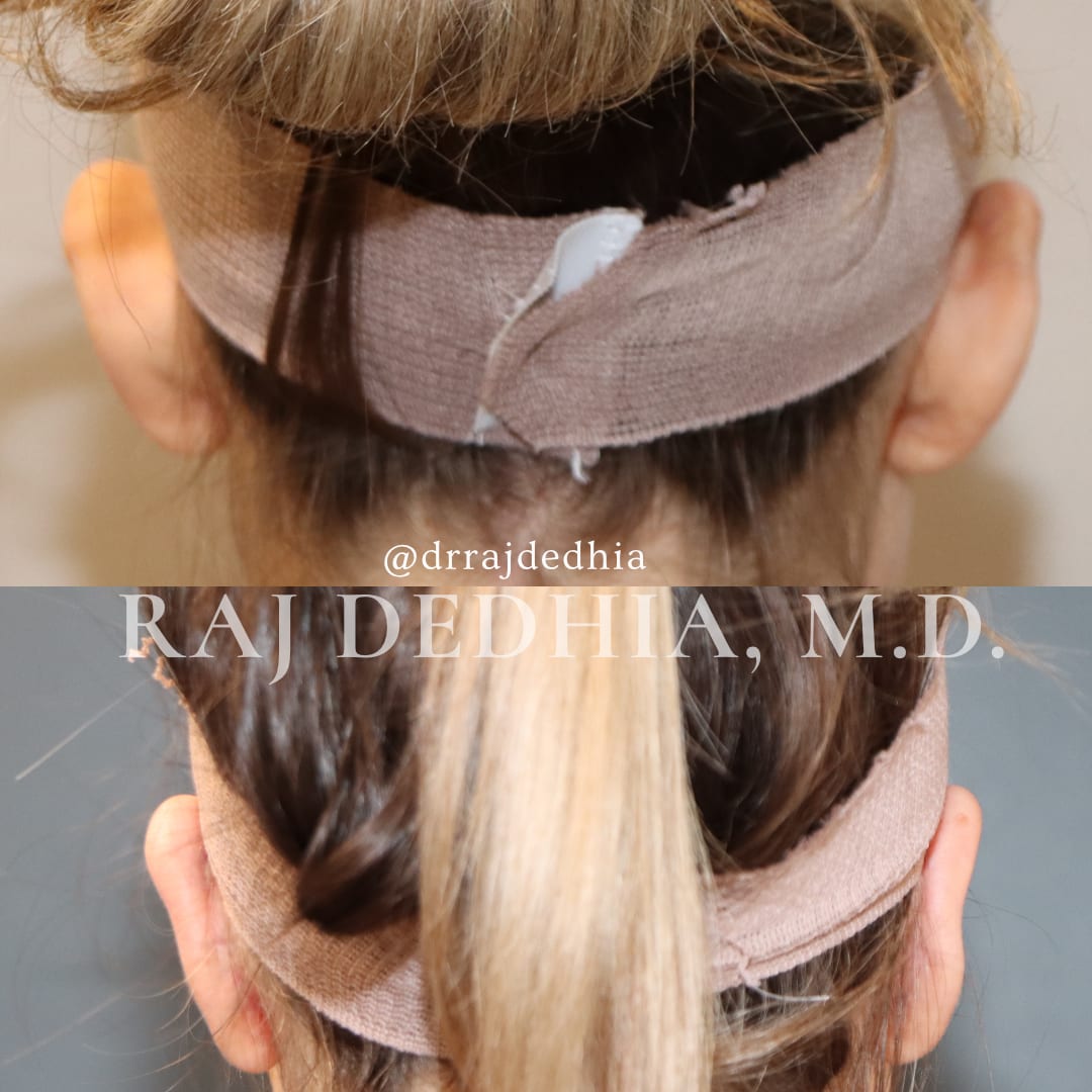 Raj Dedhia, MD Facial Plastic Surgery