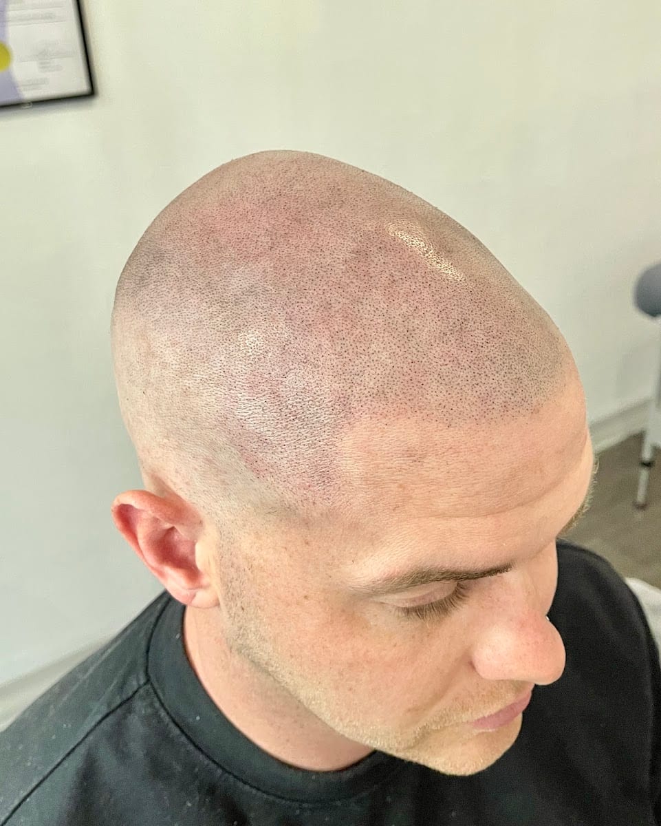 CMP Cosmetic Tattoo & Microblading