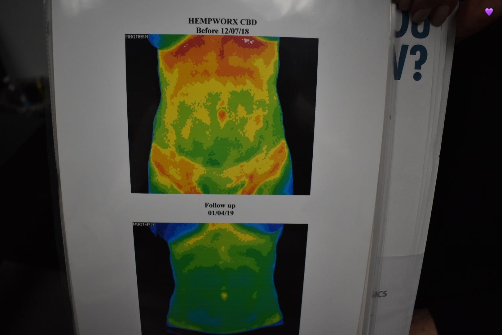 Las Vegas Thermography, photo 2