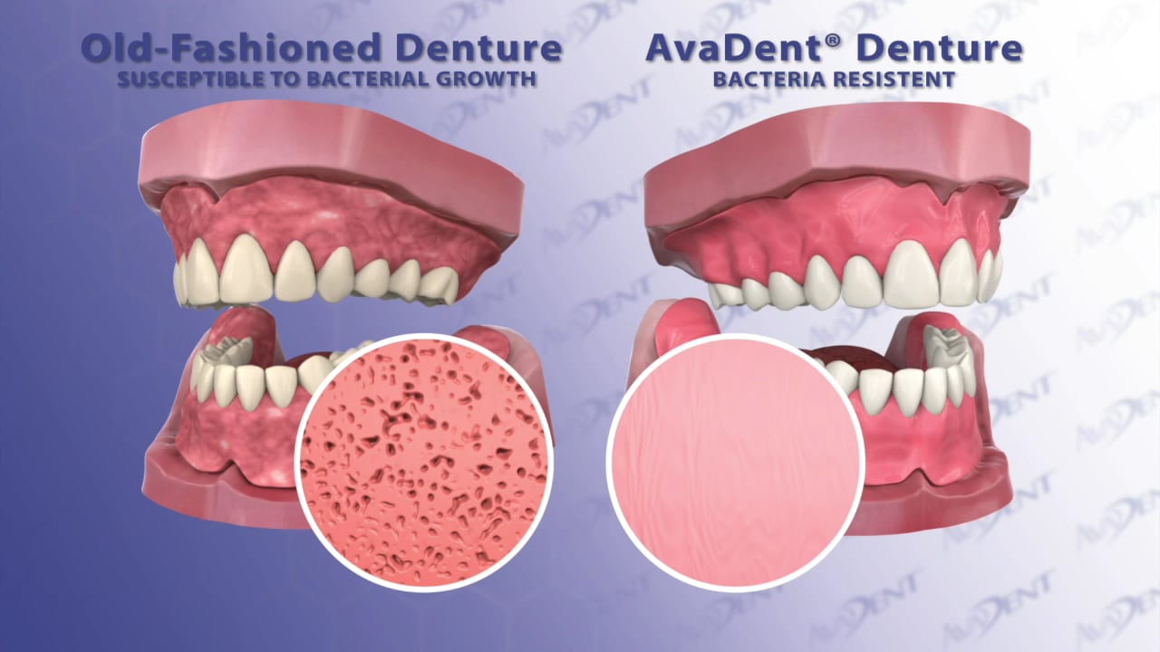 AvaDent Digital Dentures, photo 3