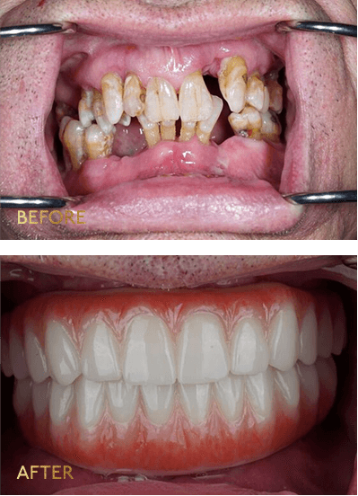Eleve Dental Cosmetic & Implant Center, photo 3
