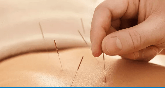 Ebs Physiotherapy St Albans: Sports Injury Specialists, photo 3