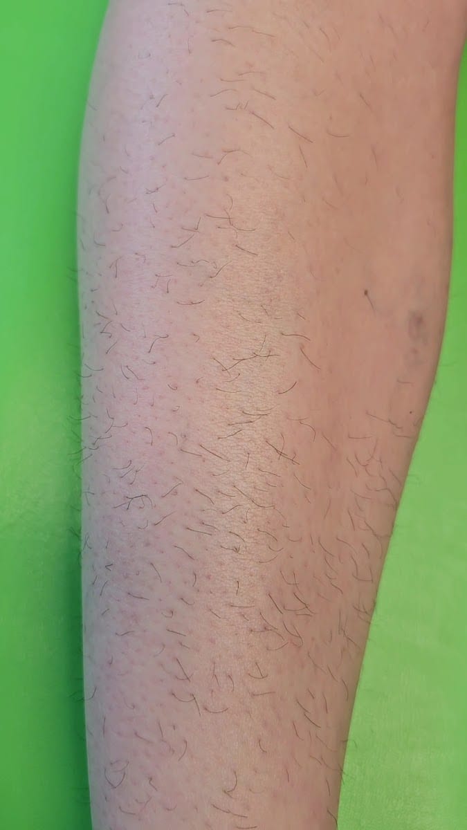 SmoothAF, photo 3