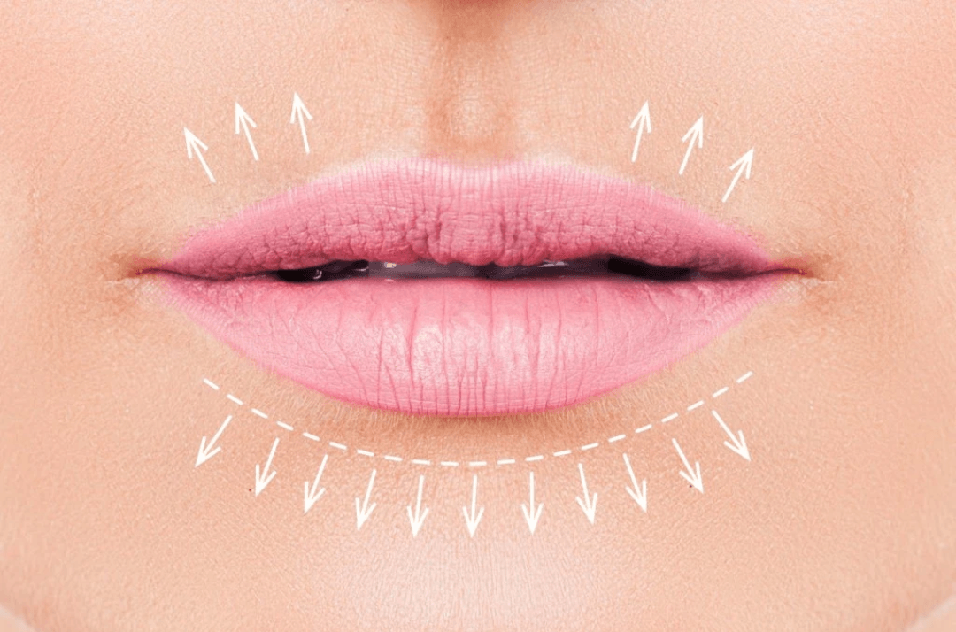 Dermatouch - Botox Fillers, Micro Needling, PRP, photo 4