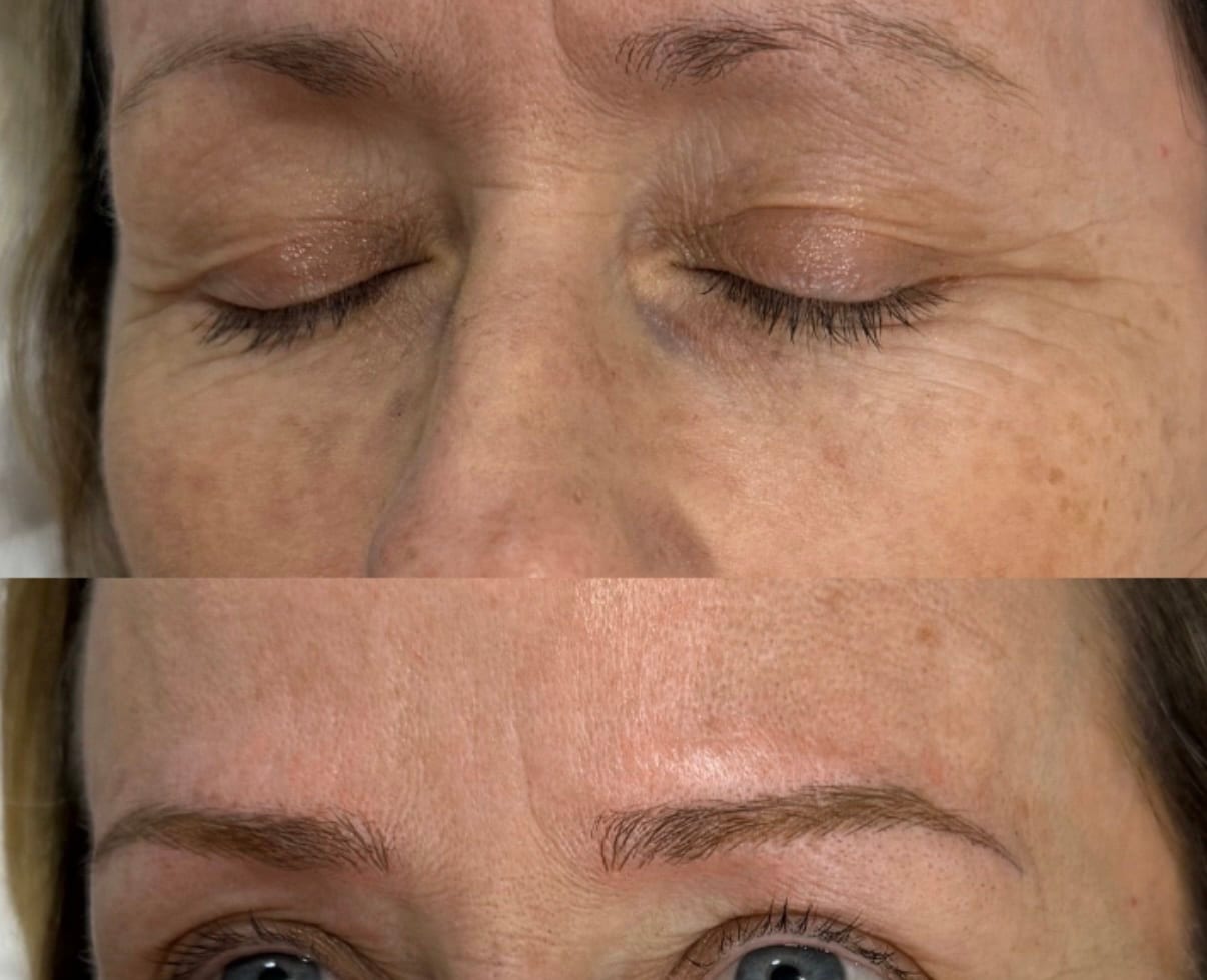 Jolán Microblading, photo 3