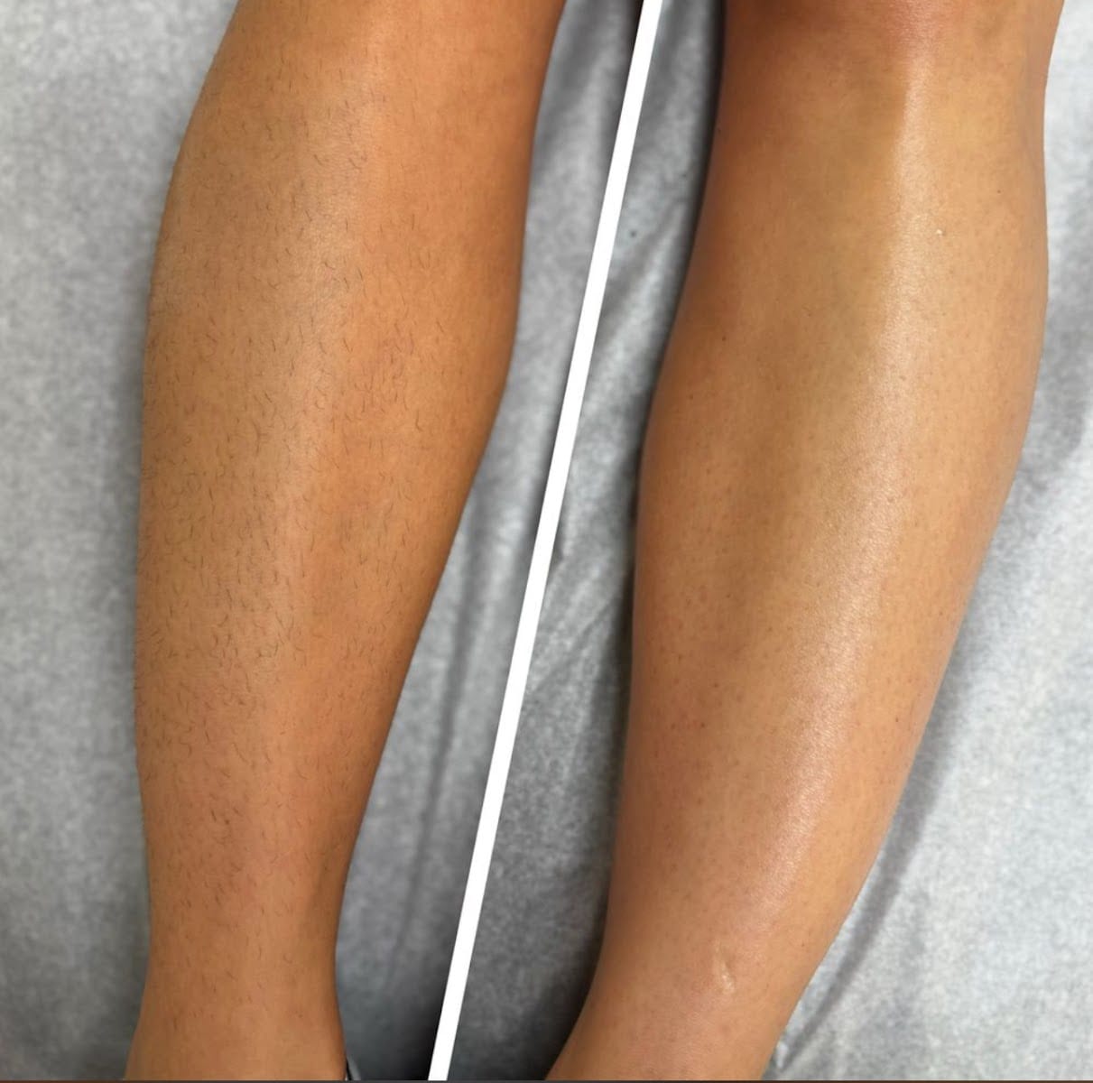 Fidelis Skin Theory, photo 2