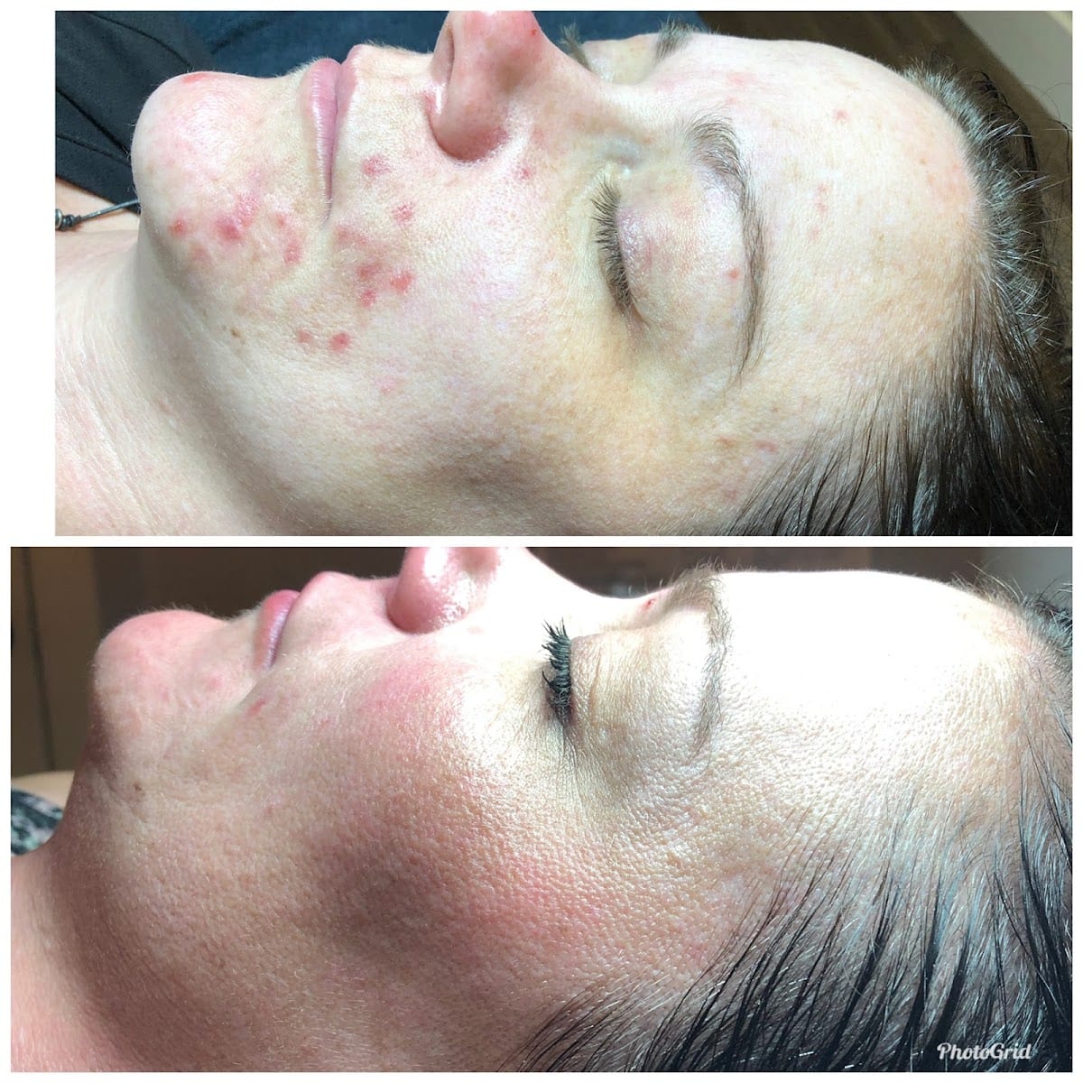 Skin Solutions Acne Clinic, photo 4