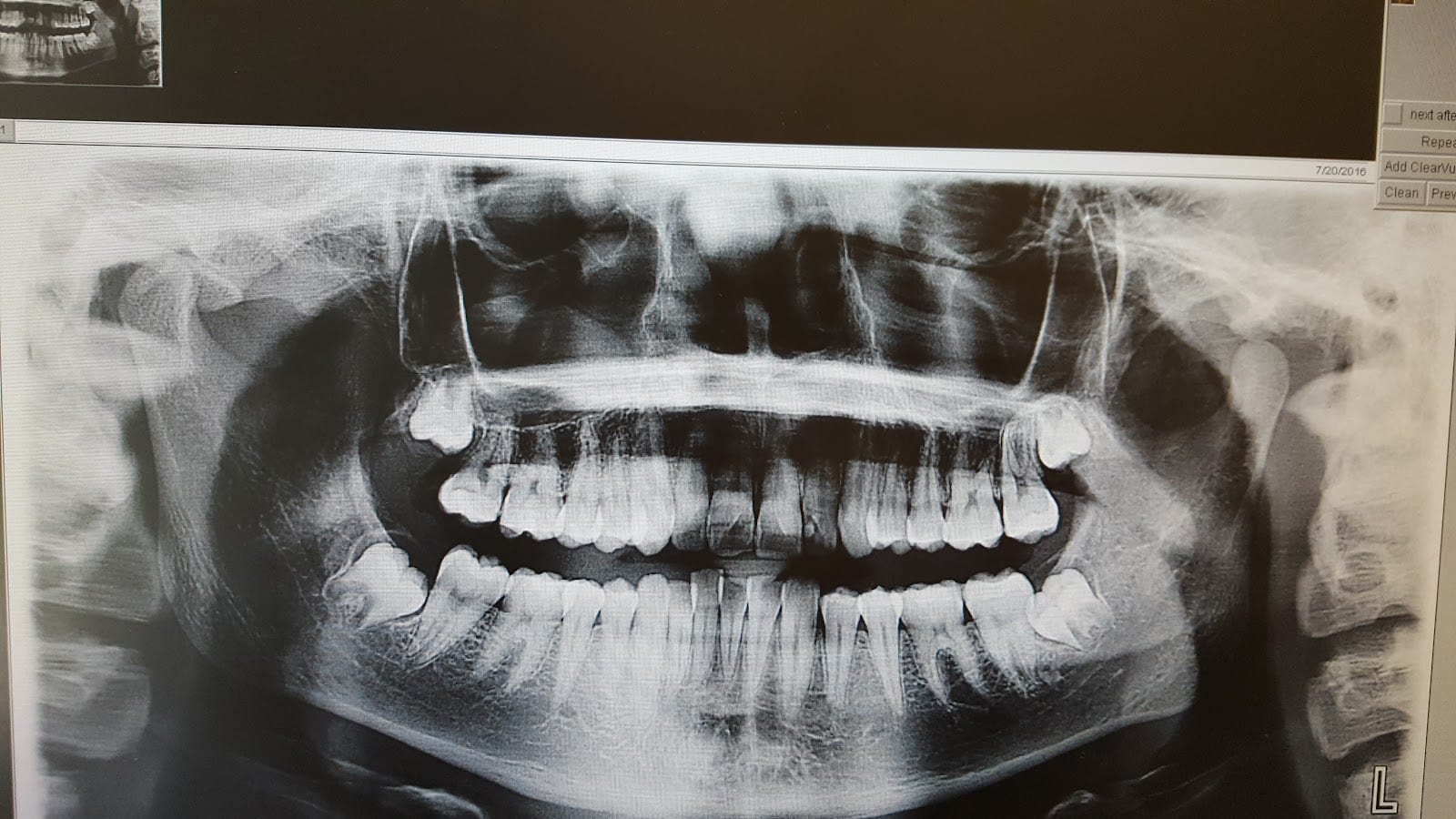 Bright Now! Dental & Orthodontics - Olympia, WA, photo 3